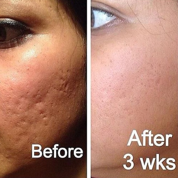 Pure Nerium Anti-Aging Age Defying Night Cream 1oz - Picture 8 of 11